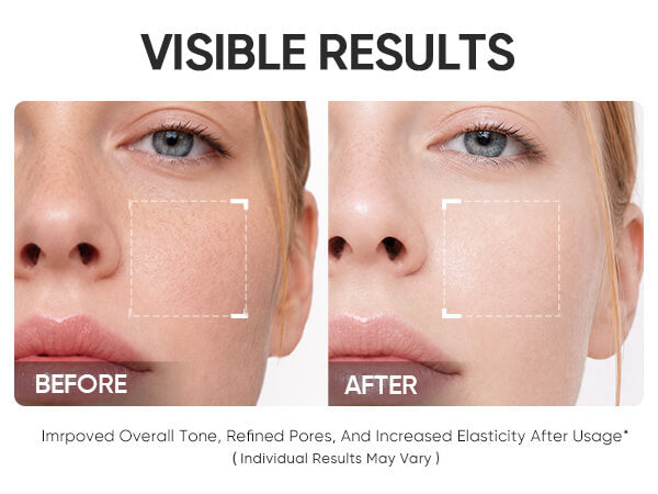 Brightening face mask with niacinamide clay complex and rose PDRN