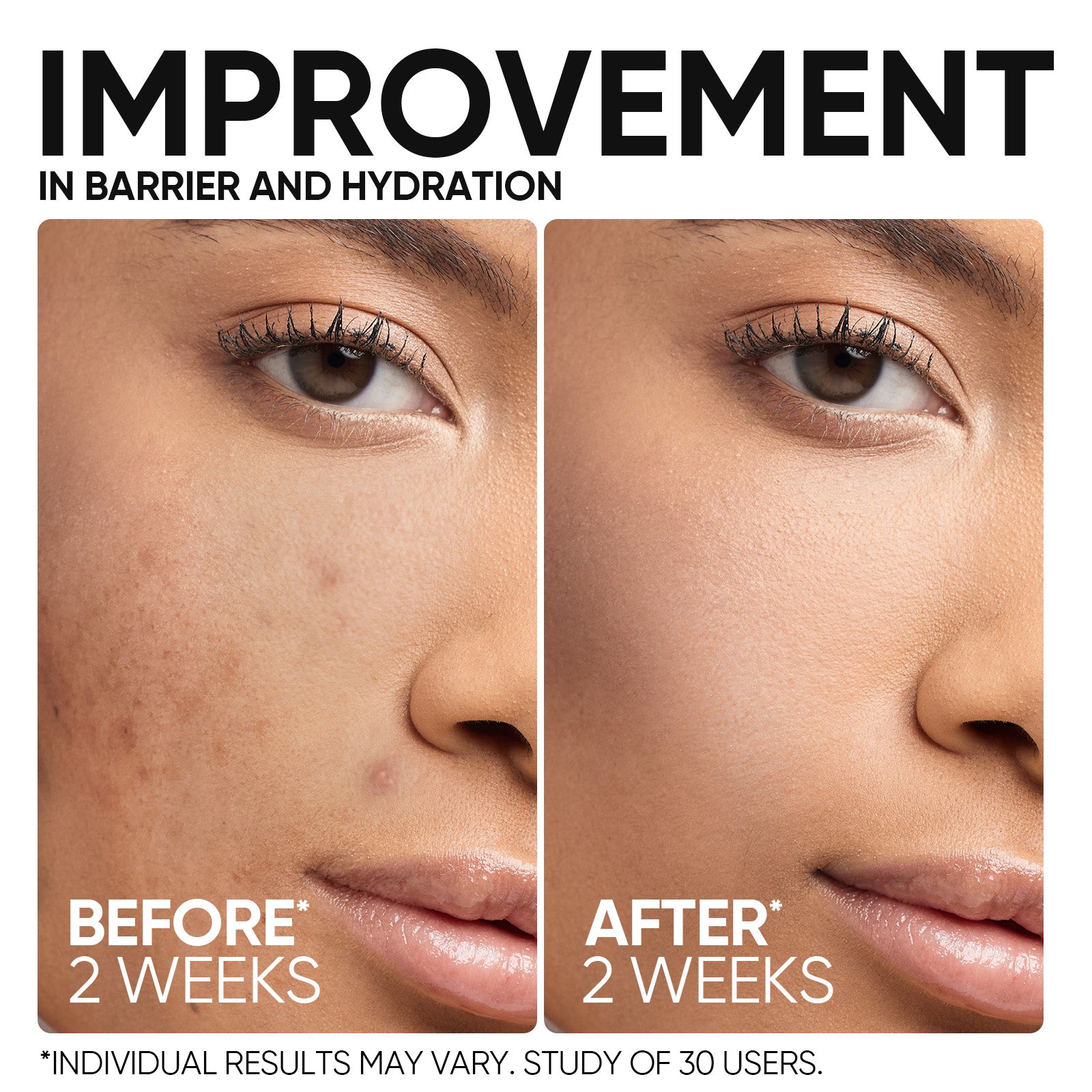 5X Ceramide Barrier Serum