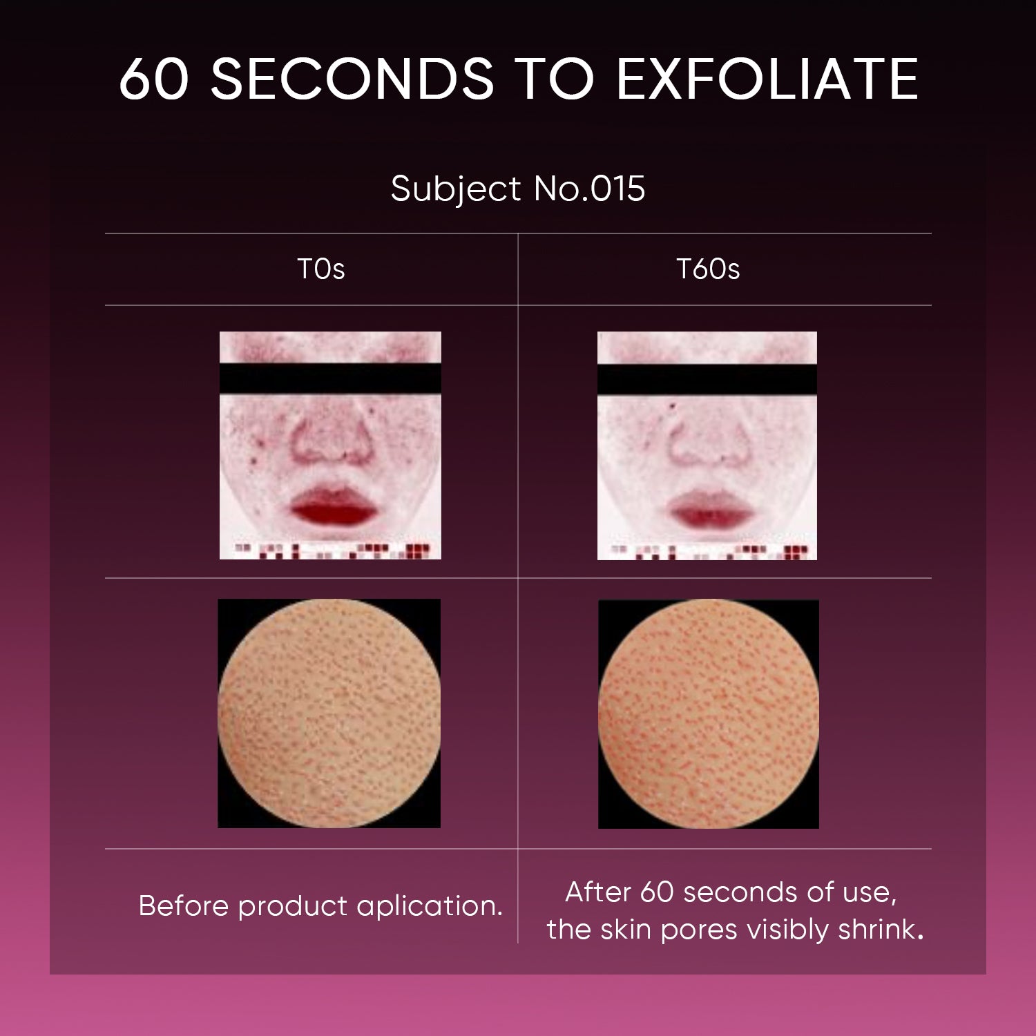 12% AHA BHA PHA LHA Peeling Solution Serum