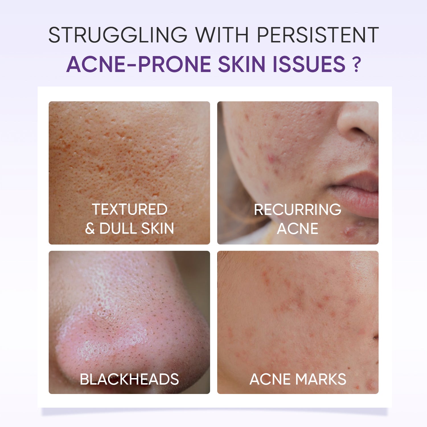 Lactic Acid Exfoliating Serum Smooth & Bright Skin