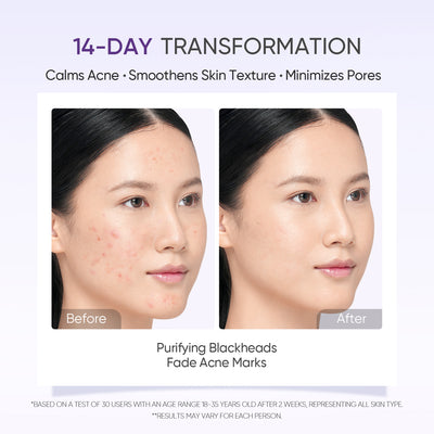 Lactic Acid Exfoliating Serum Smooth & Bright Skin