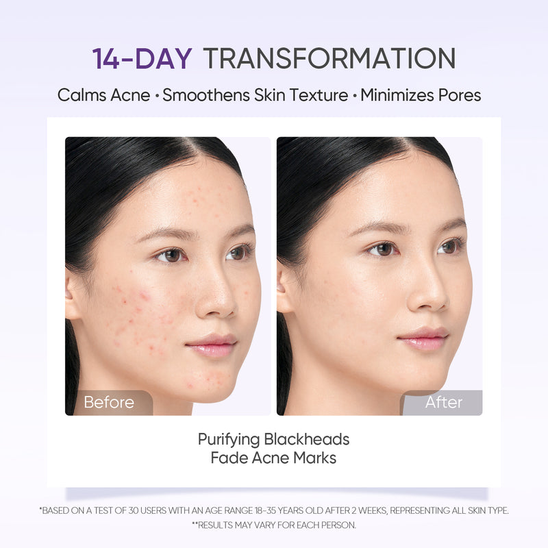 Lactic Acid Exfoliating Serum Smooth & Bright Skin