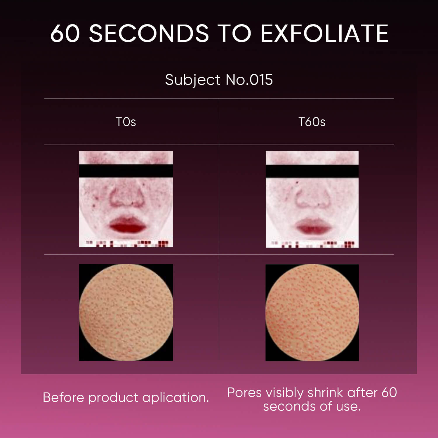 12% AHA BHA PHA LHA Peeling Solution Serum