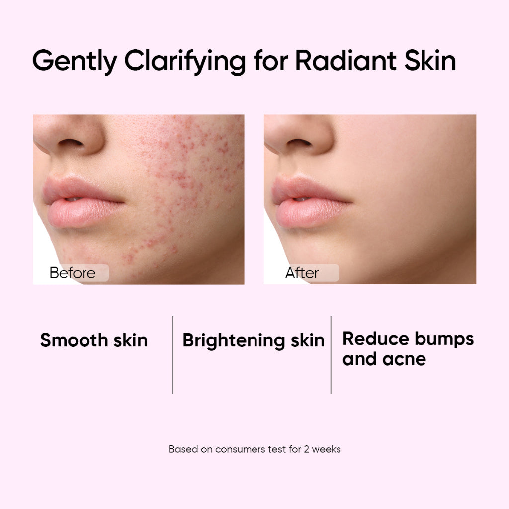 Glycolic Acid Daily Clarifying Toner