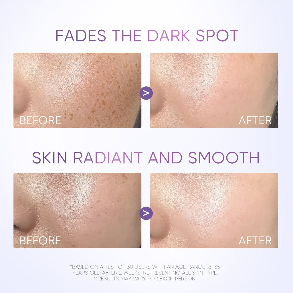 Symwhite 377 Sérum para manchas oscuras