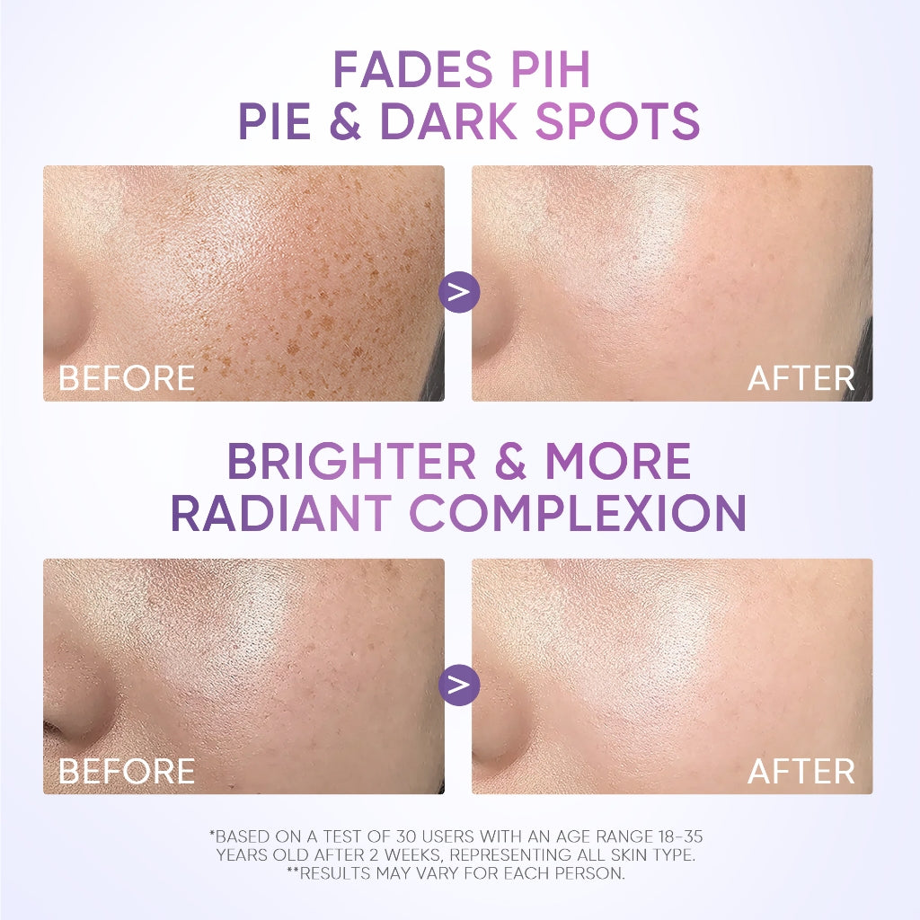 SymWhite 377 Feuchtigkeitsgel gegen dunkle Flecken