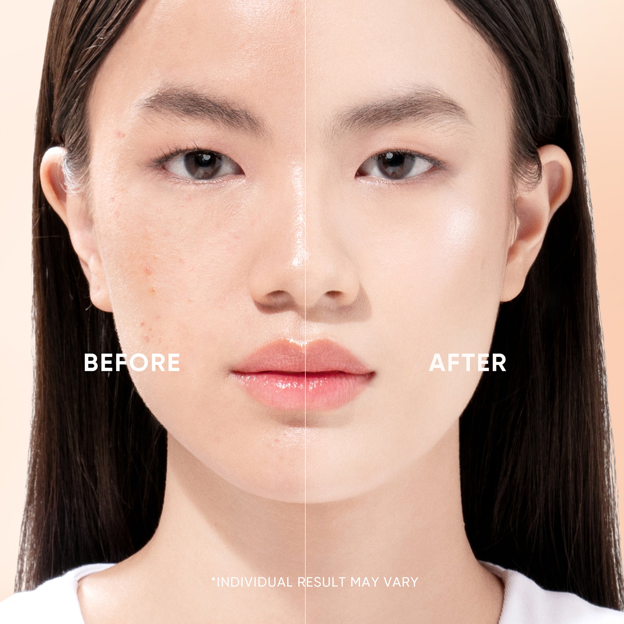 【New Launch】Retinol Skin Renewal Serum 20ml