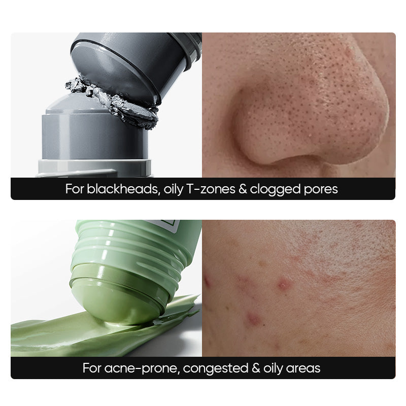 #Option_Acne Care + Blackhead Control