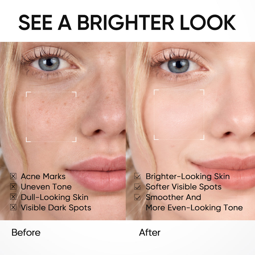 10% Niacinamide Brightening Serum