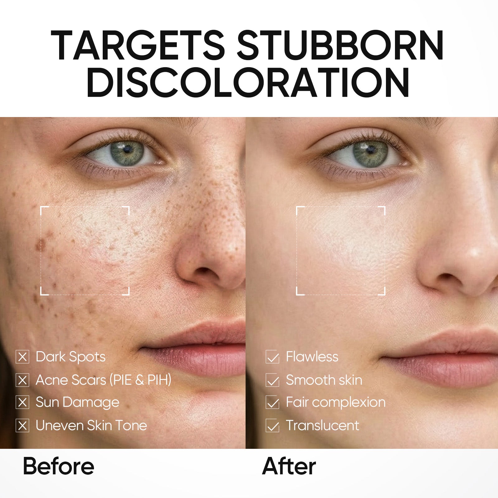 SymWhite 377 Dark Spot Moisture Gel