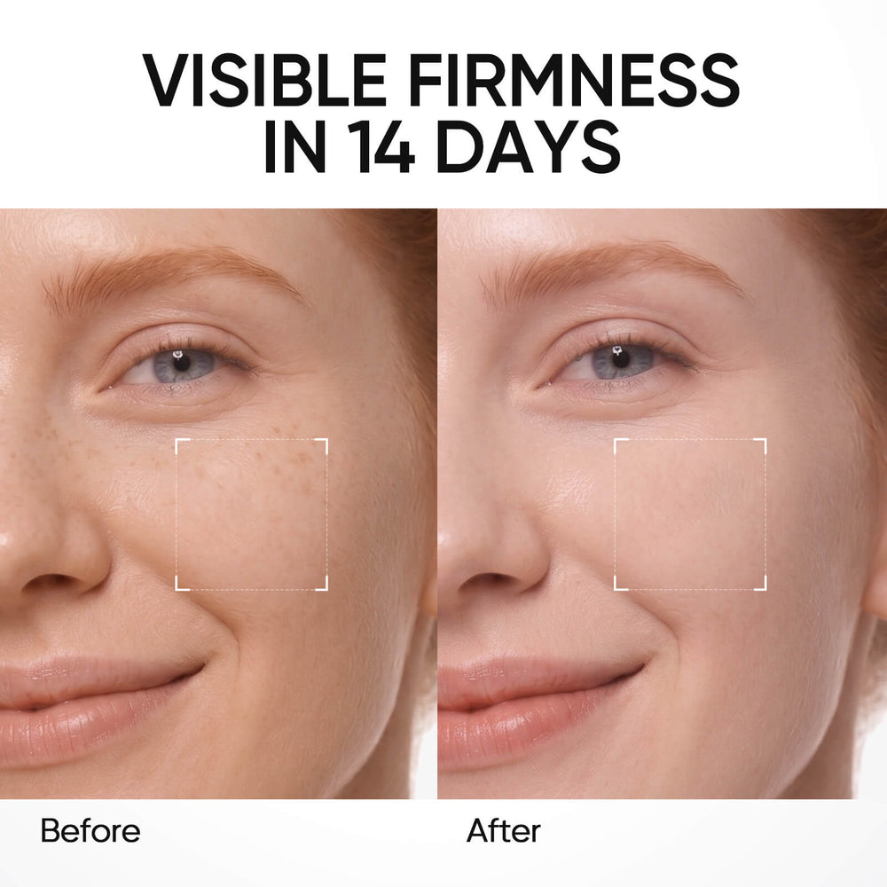 PDRN Brightening One Time Ampoule Serum 30pcs