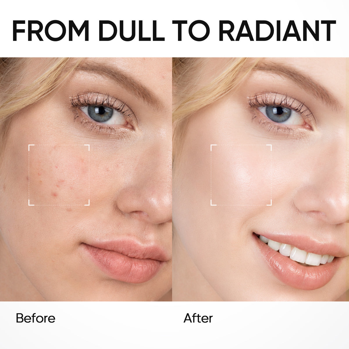 MSH Niacinamide Brightening Moisture Gel
