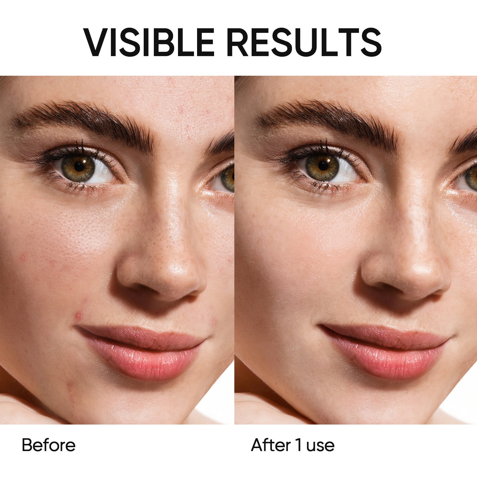 Niacinamid Aufhellungs-Booster Tonerde-Stick