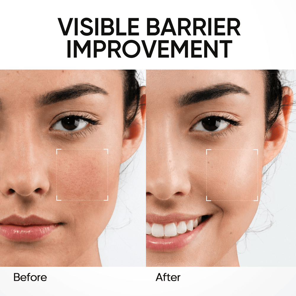 5X Ceramid Barriere Feuchtigkeits-Gel