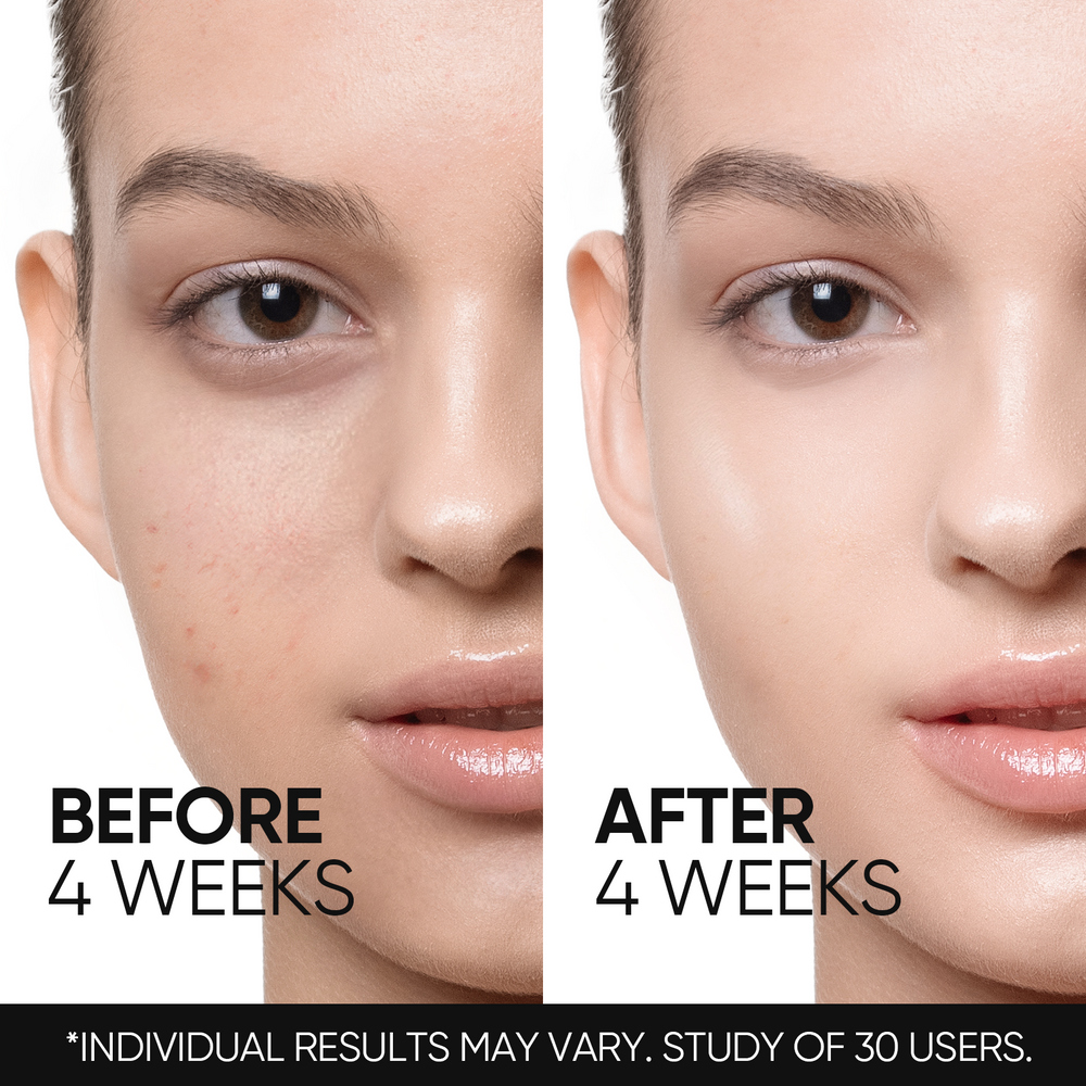 Retinol Skin Renewal Moisturizer Acne & Anti-Aging Night Cream