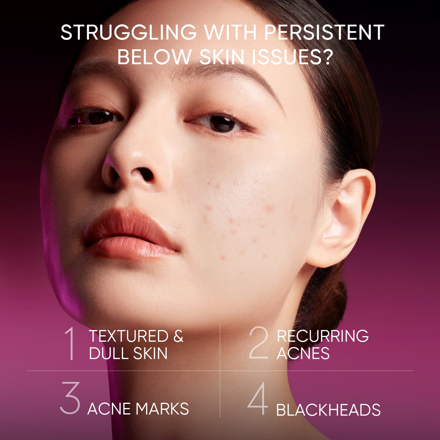 【NEW LAUNCH】2% AHA BHA PHA LHA Peeling Solution