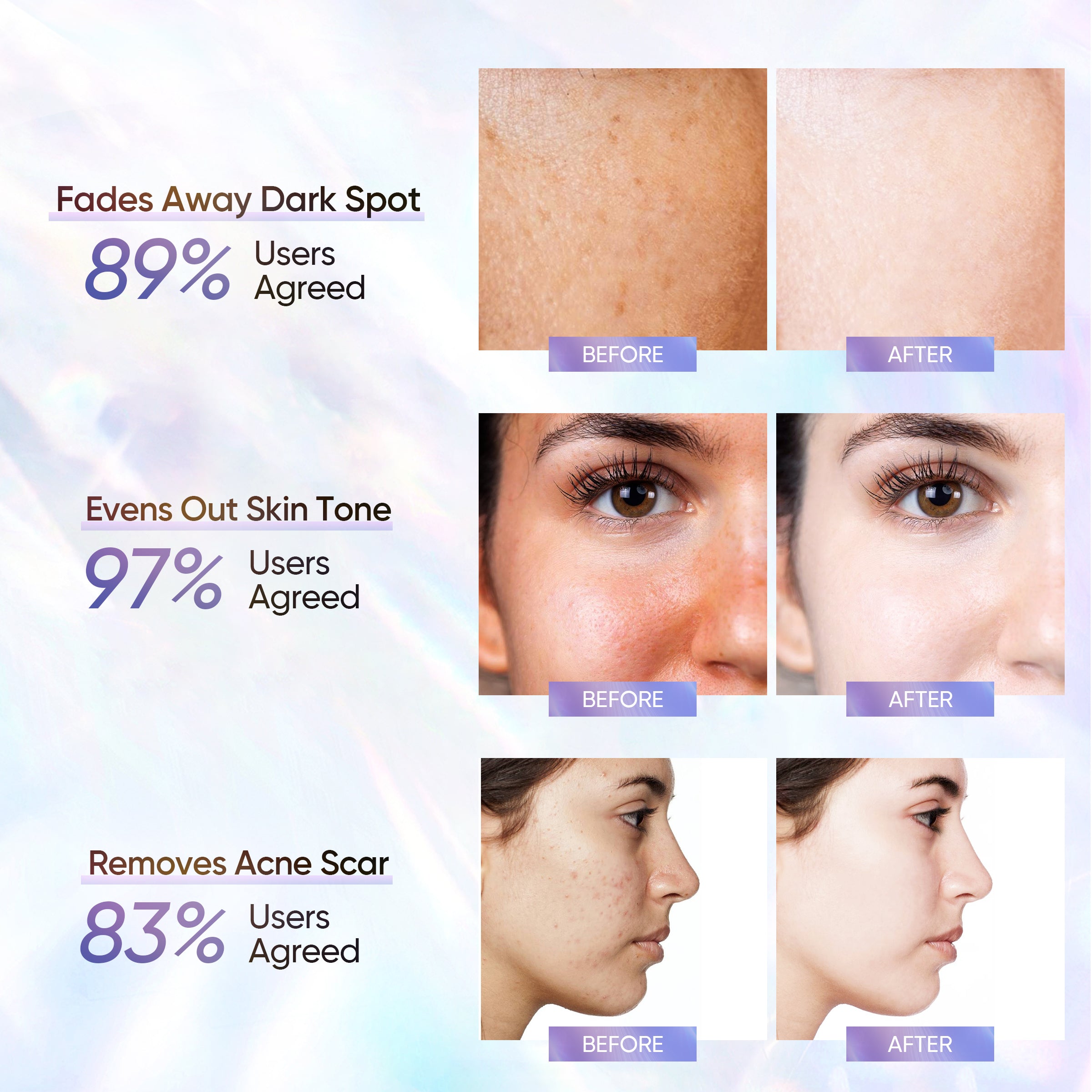 NIACINAMIDE BRIGHTENING SERUM