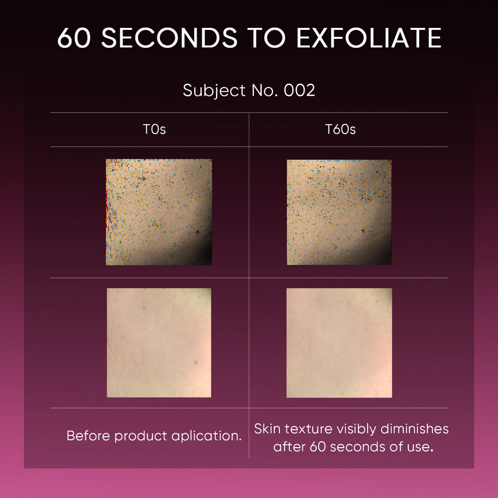 12% AHA BHA PHA LHA Peeling-Lösung