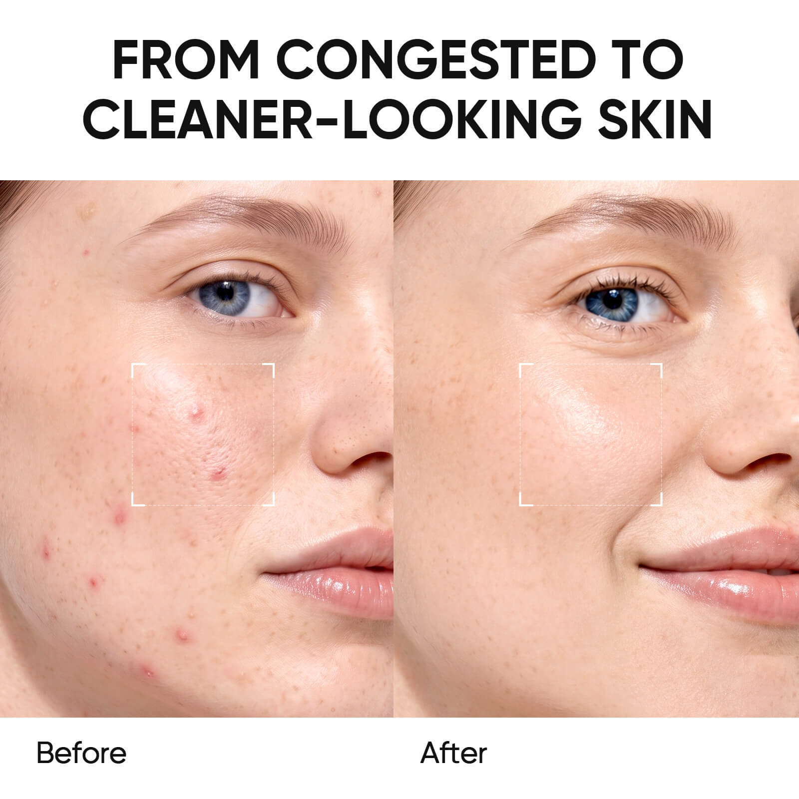 Blackhead Control & Acne Care Deep Cleansing Clay Stick Duo Set 2pcs