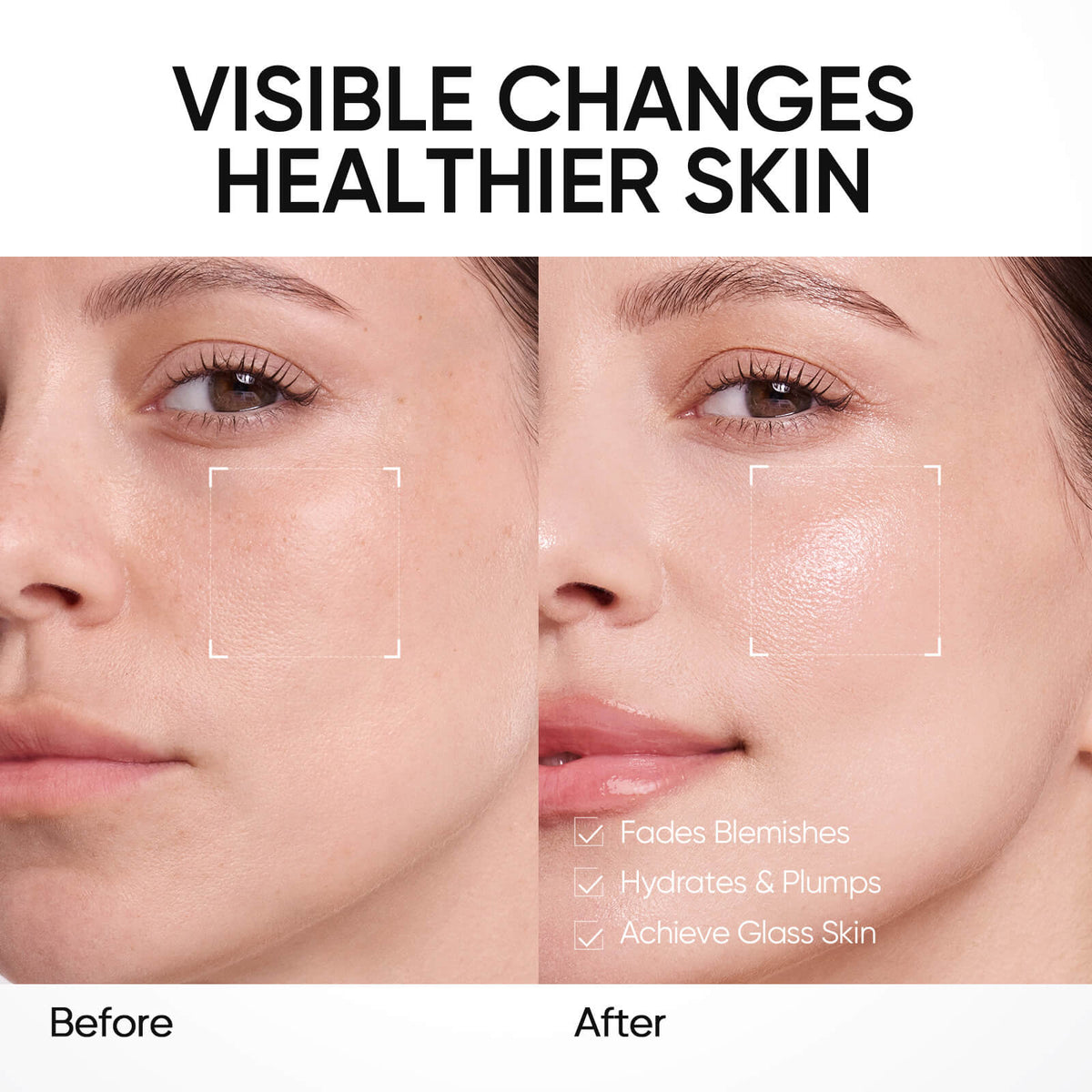 PDRN Bright & Smooth Moisture Gel Cream Moisturizer