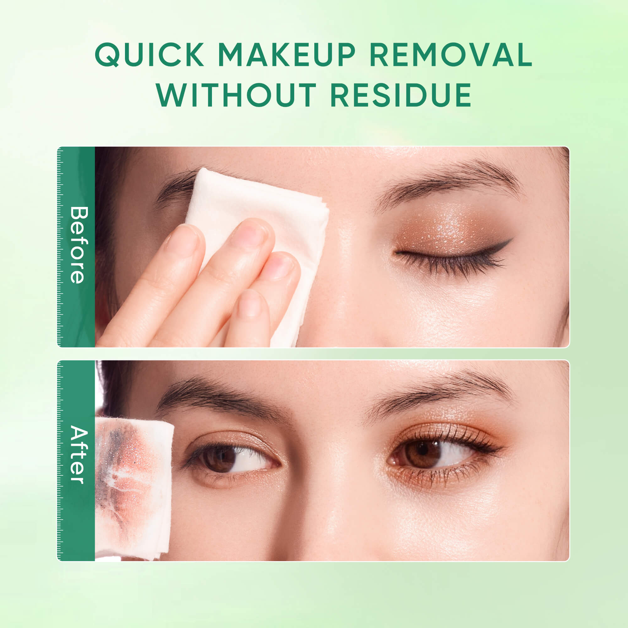 Centella Acne Care Micellar Cleansing Wipes for Acne-Prone Skin