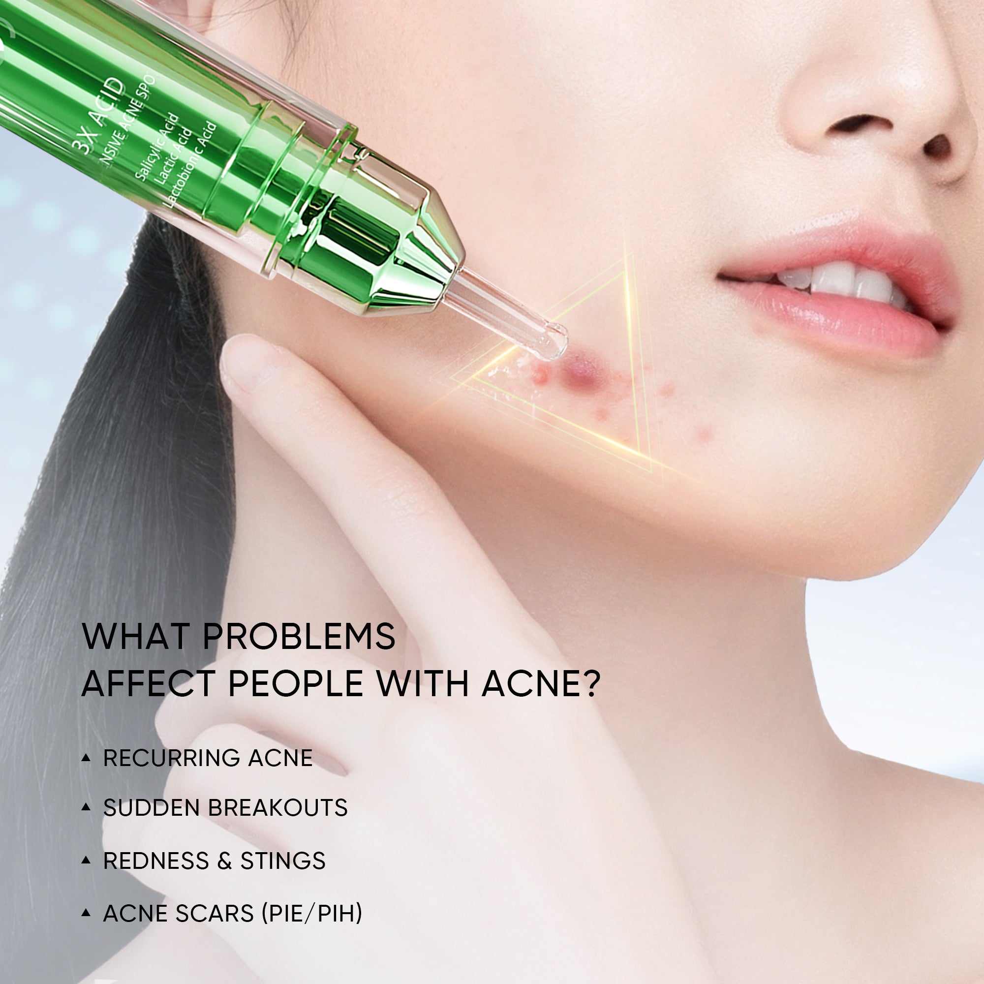 [NEW LAUNCH] SKINTIFIC 3X ACID INTENSIVE ACNE SPOT 11g