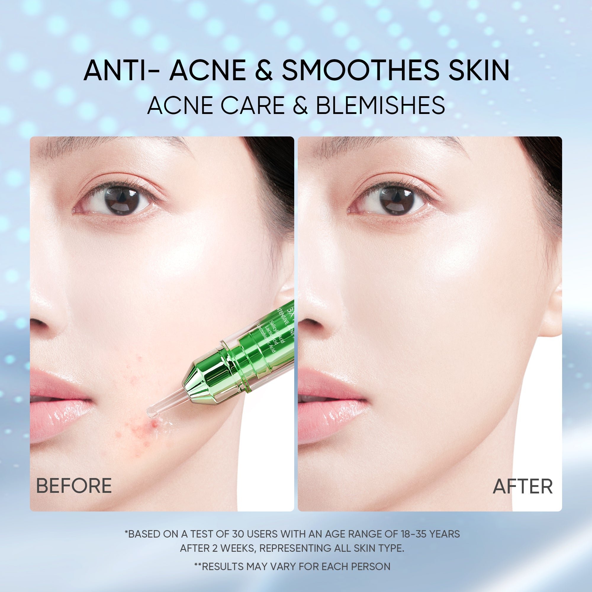 [NEW LAUNCH] SKINTIFIC 3X ACID INTENSIVE ACNE SPOT 11g